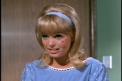In fact, it looks like someone attacked her face with a bingo dauber.